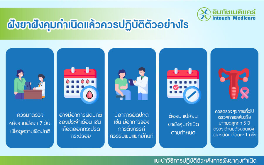 แนะนำวิธีปฏิบัติตัวหลังการฝังยาคุมกำเนิด