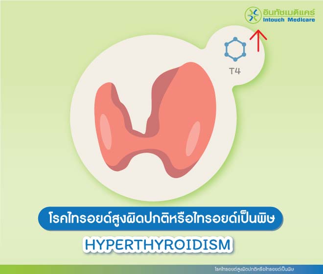 โรคไทรอยด์สูงผิดปกติหรือไทรอยด์เป็นพิษ