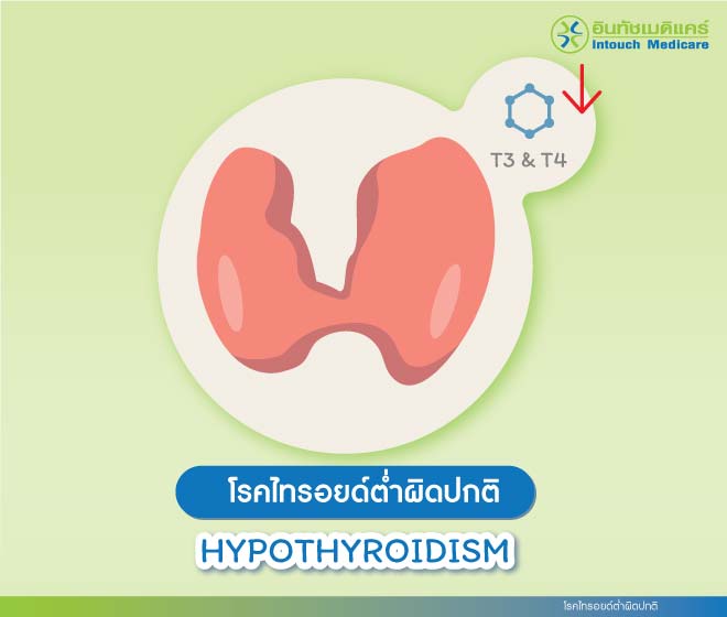 โรคไทรอยด์ต่ำผิดปกติ