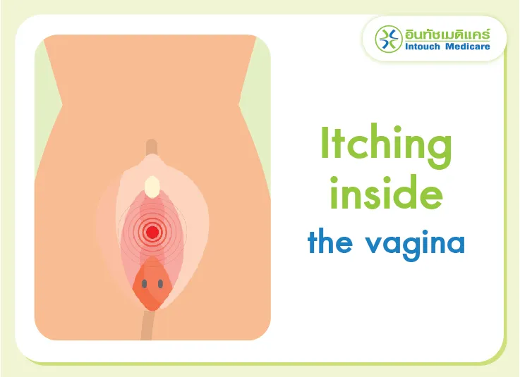 Itching inside the vagina