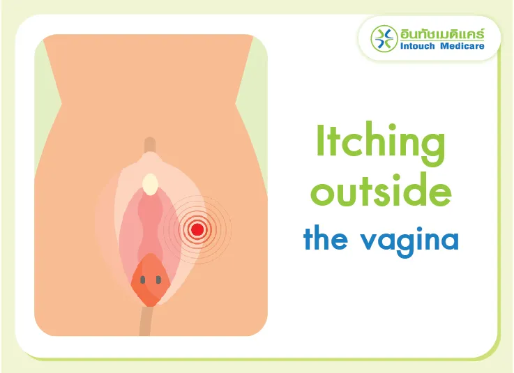 Itching outside the vagina