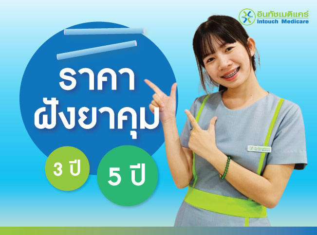 ราคา ฝังยาคุม อย่างเดียว