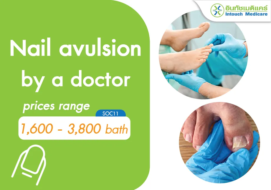 The price for nail avulsion (nail removal).