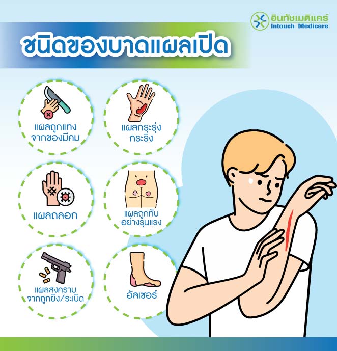 ชนิดของบาดแผลเปิด