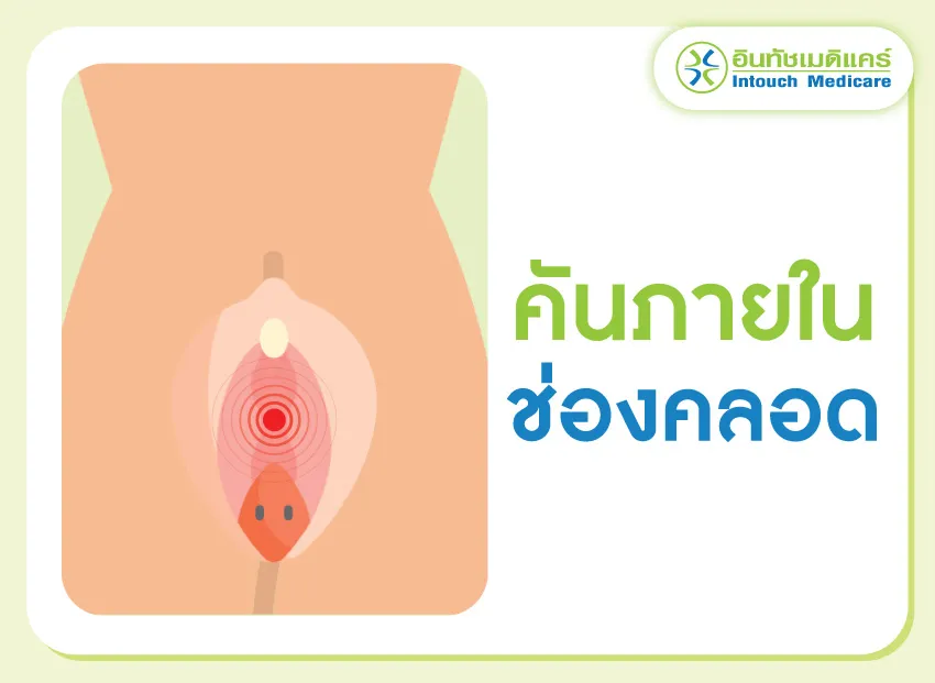 คันภายในช่องคลอด